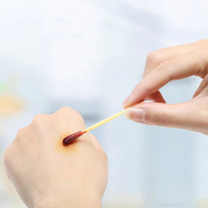 Lot de bâtonnets imprégnés alcool ou povidone iodée "Sanke Rescue - Swab pack" - Planète Rando
